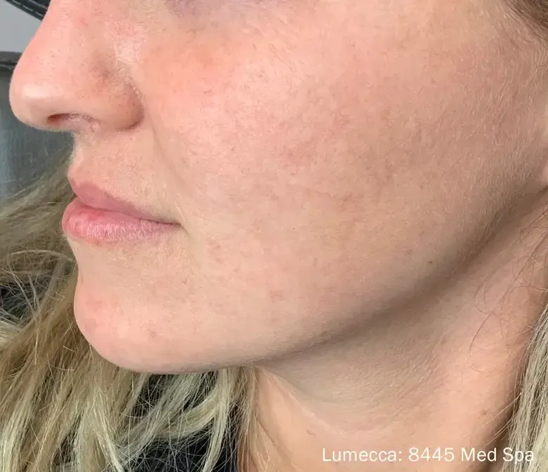 Lumecca 8