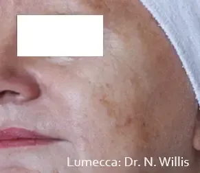 Lumecca 12