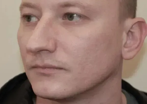 Рубцы 6