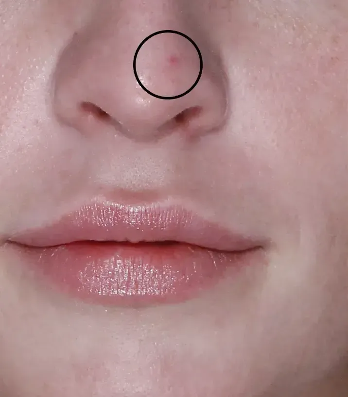 Lumecca 18