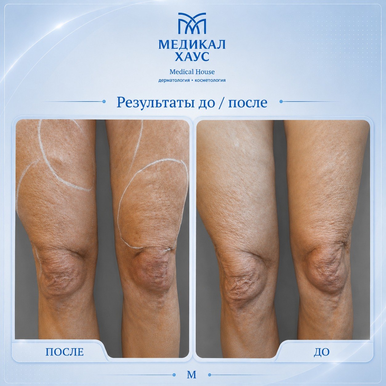 Морфеус 9