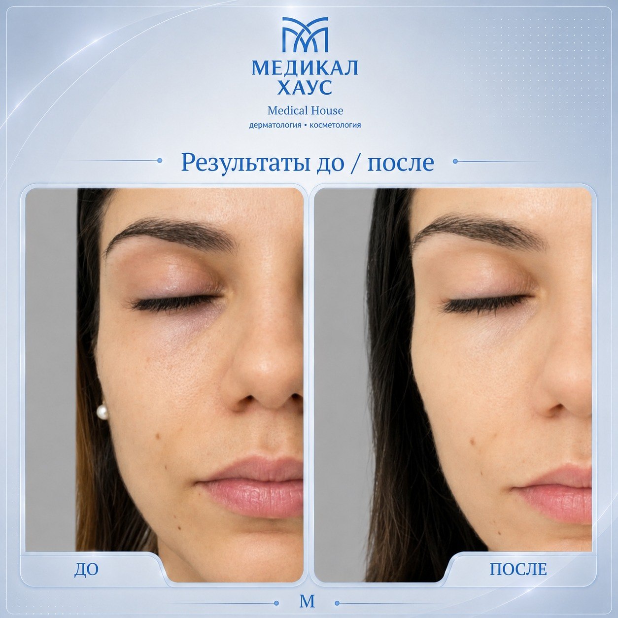 Морфиус 8