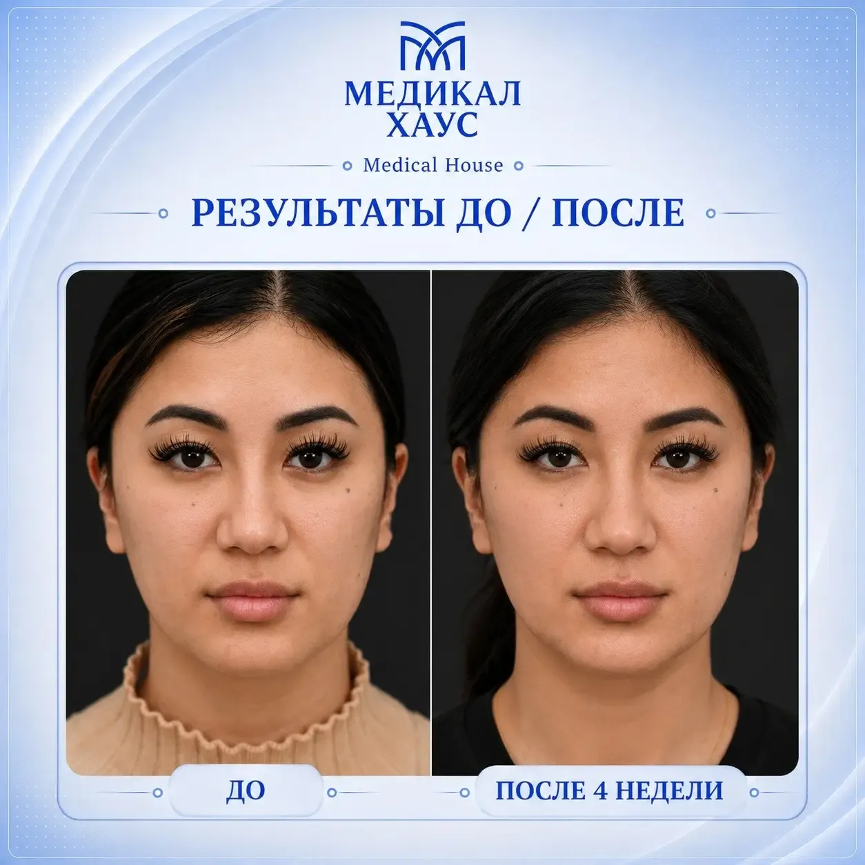 Олиджио4