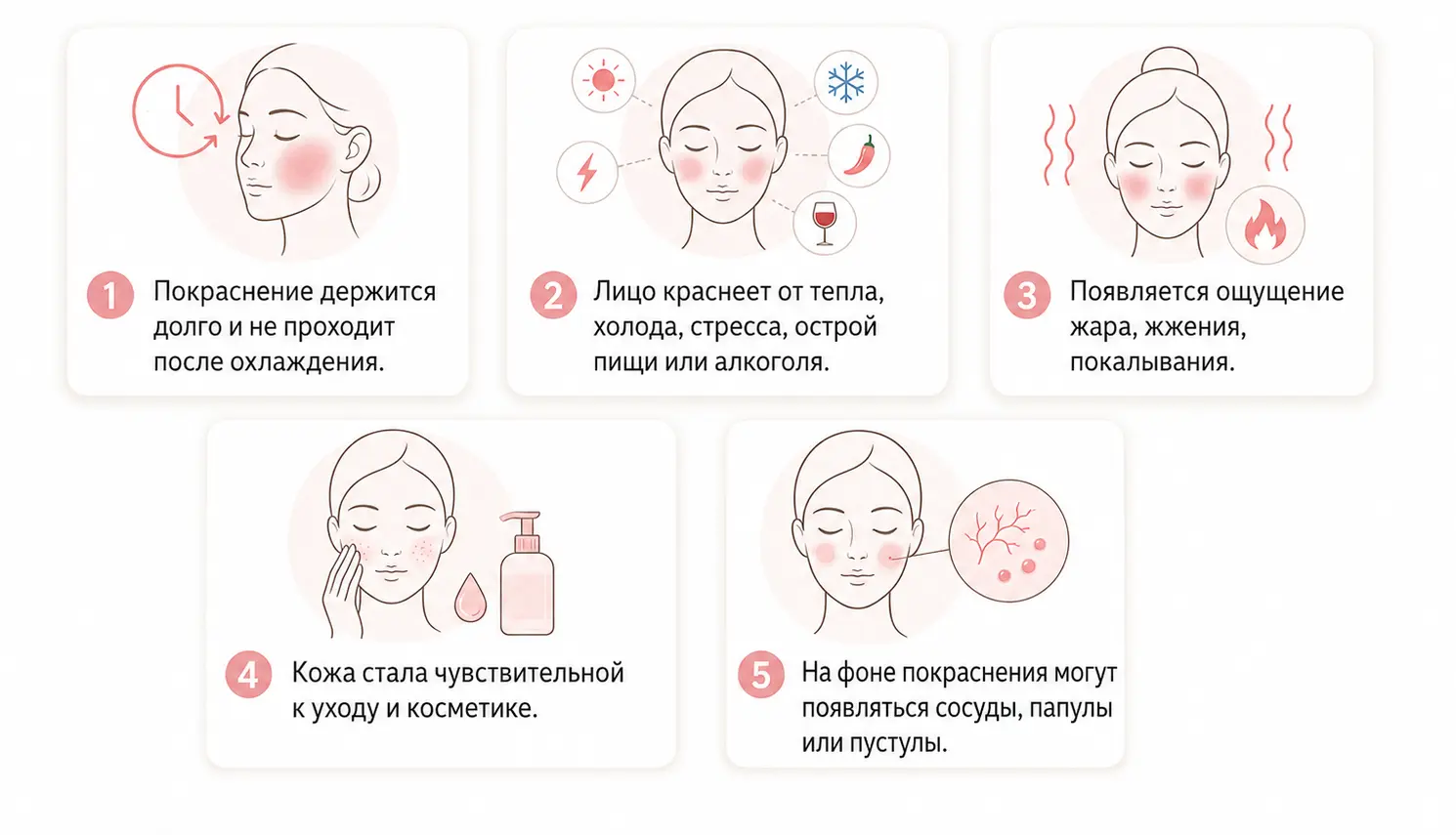 Зоны проявления купероза на лице